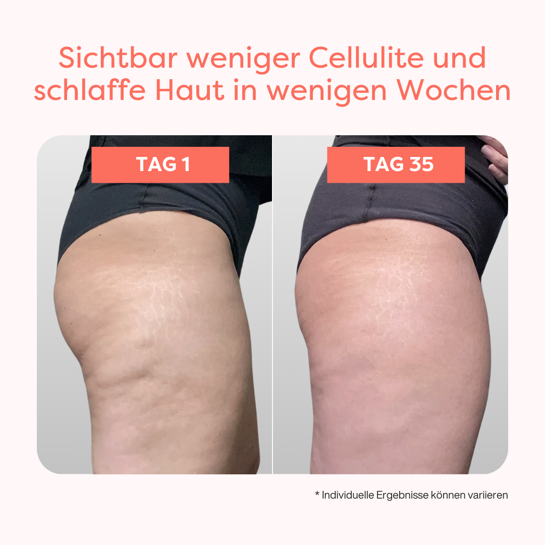 Thermoslim Body Sculpting Gerät