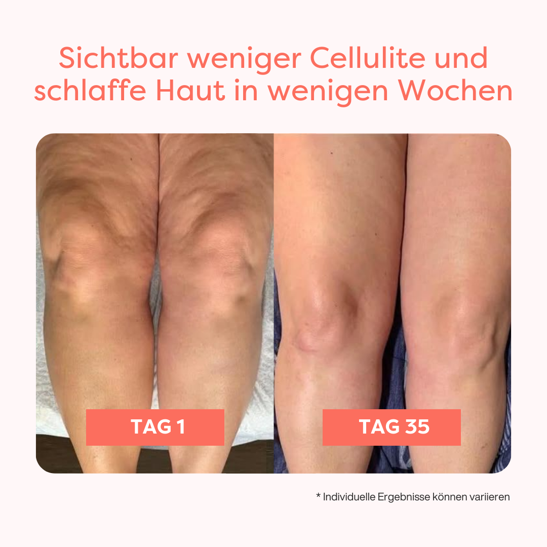 Thermoslim Body Sculpting Gerät